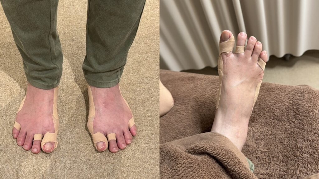 靴でも目立たないテーピング法