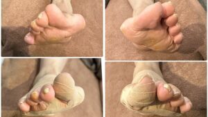 距骨調整 50代男性