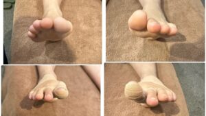 距骨調整-50代女性_ゆう助はりきゅう接骨院