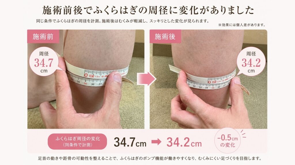 【夕方の足パンパンを根本改善】ふくらはぎが軽くなる「距骨調整」のスゴい効果