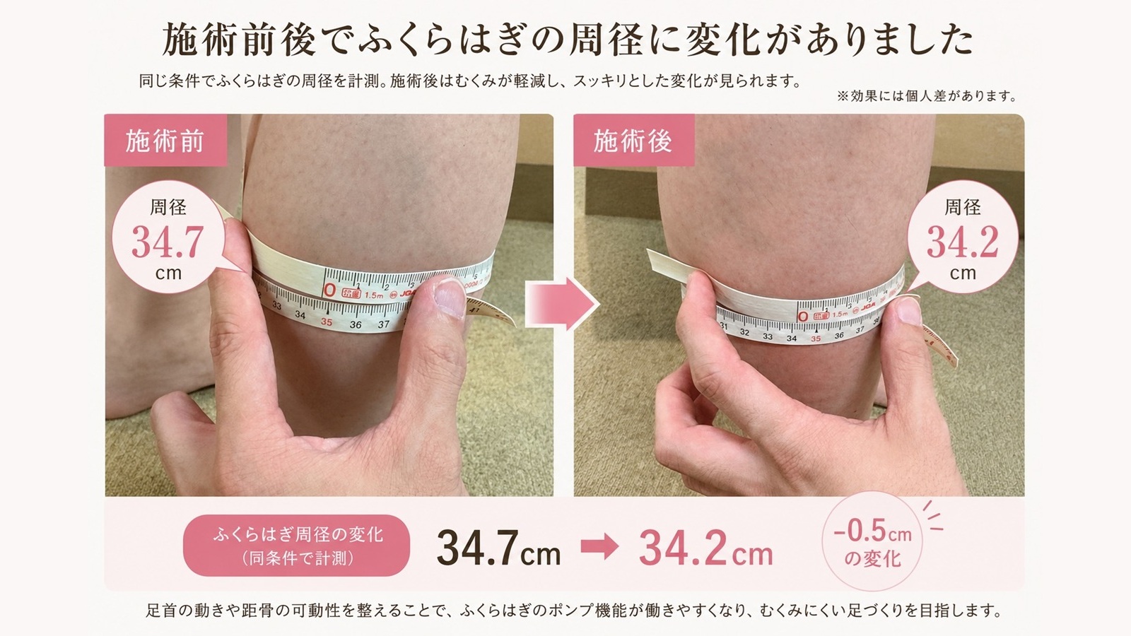 【夕方の足パンパンを根本改善】ふくらはぎが軽くなる「距骨調整」のスゴい効果