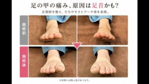 足の甲が痛い…原因は痛む場所ではなく「足首のねじれ」？【50代女性の事例】