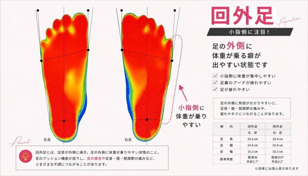 【足が疲れやすい人の特徴】「回外足」？3Dスキャナーで分かる危険性と根本改善法